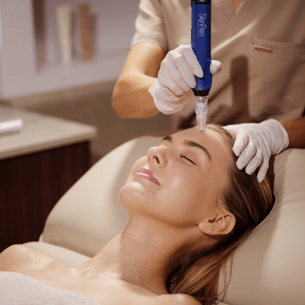About SkinPen® Microneedling