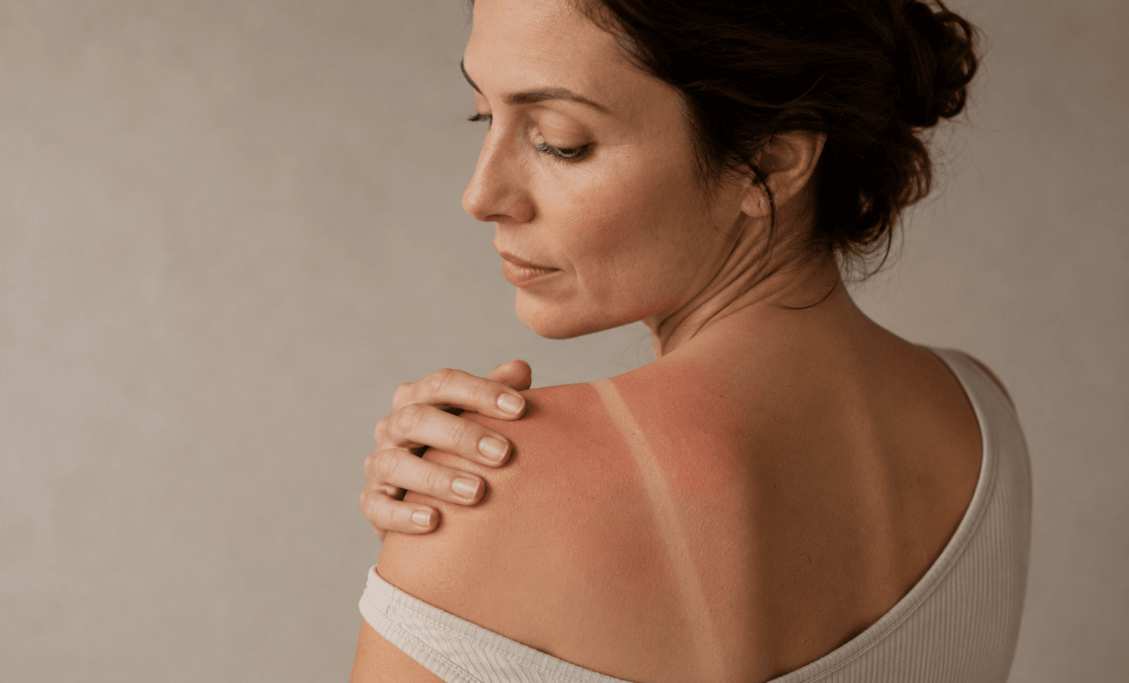 skin cancer blog.png